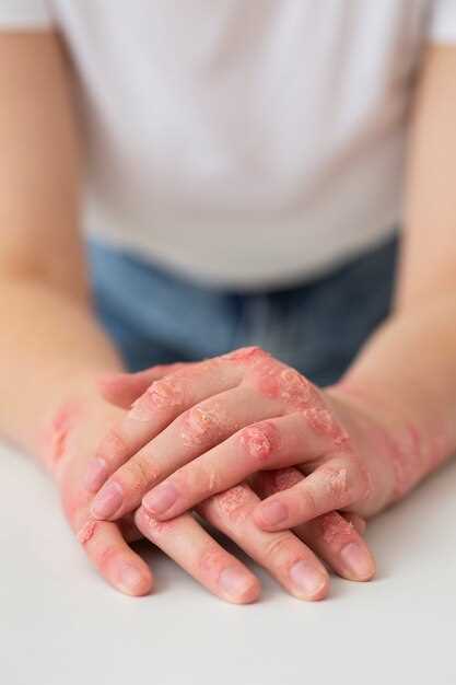 Causes of Skin Rash