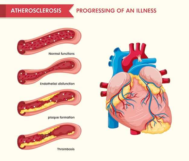 Definition and Mechanism