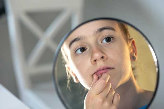 Does losartan cause acne