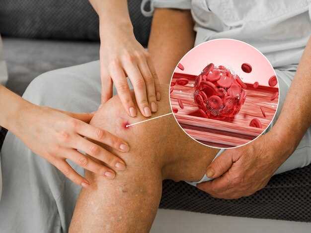 Losartan and vasculitis