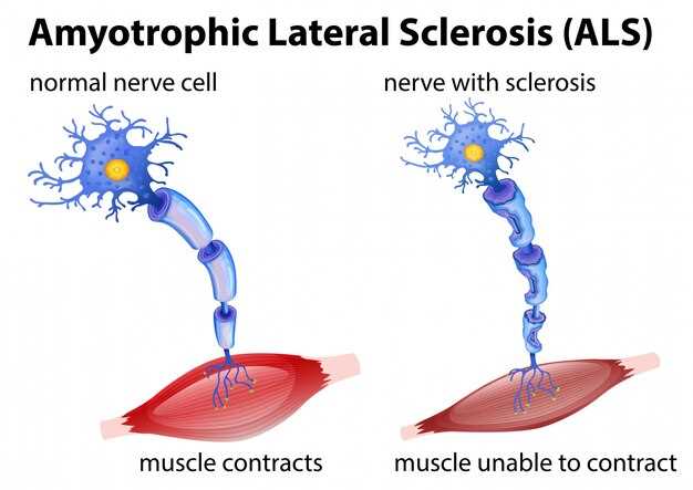 Losartan receptor at1